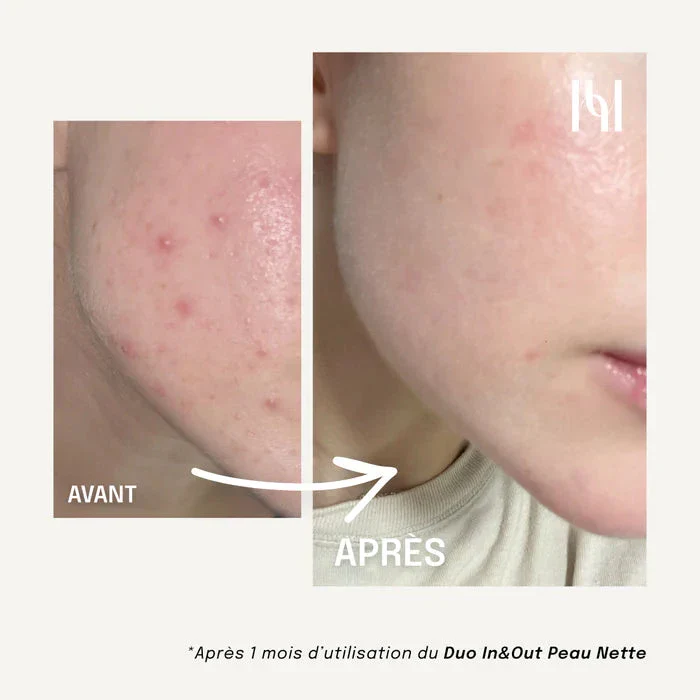 Complément Alimentaire Liquide - Visage Peau nette - Image 4