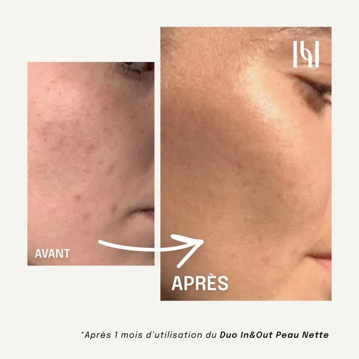 Complément Alimentaire Liquide - Visage Peau nette - Image 6